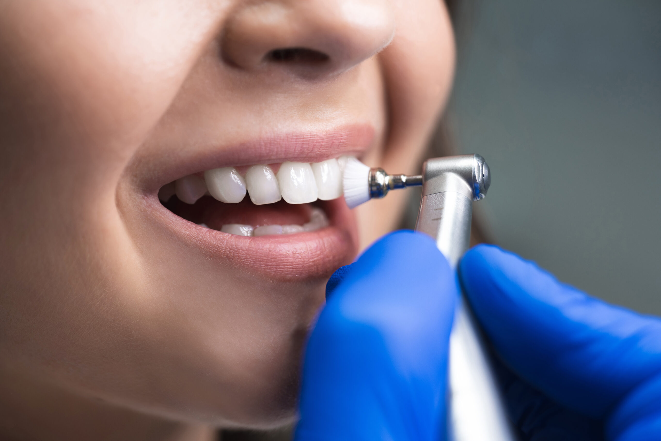 A dental examination